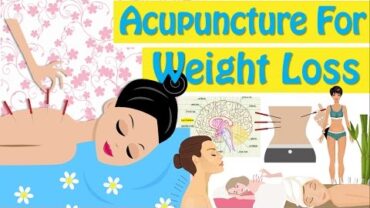 VIDEO: Acupuncture For Weight Loss How Does Acupuncture Work